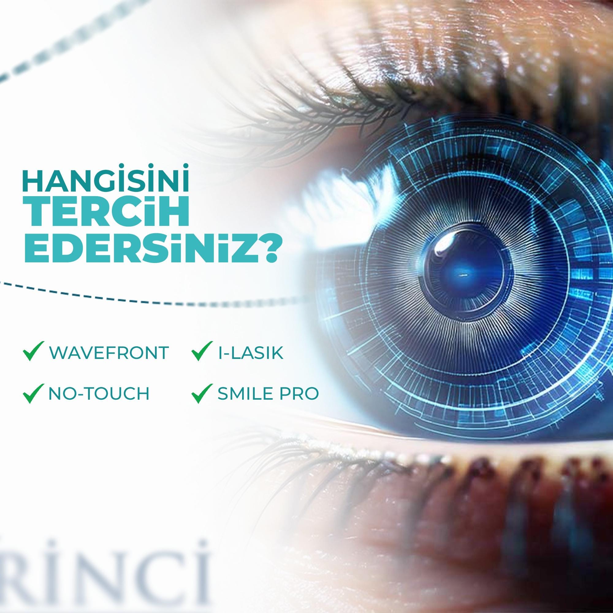 No Touch, SMILE ya da LASIK: Hangisi Sizin İçin Uygun? No Touch Smile ve Lasik lazer göz çizdirme yöntemleri karşılaştırması