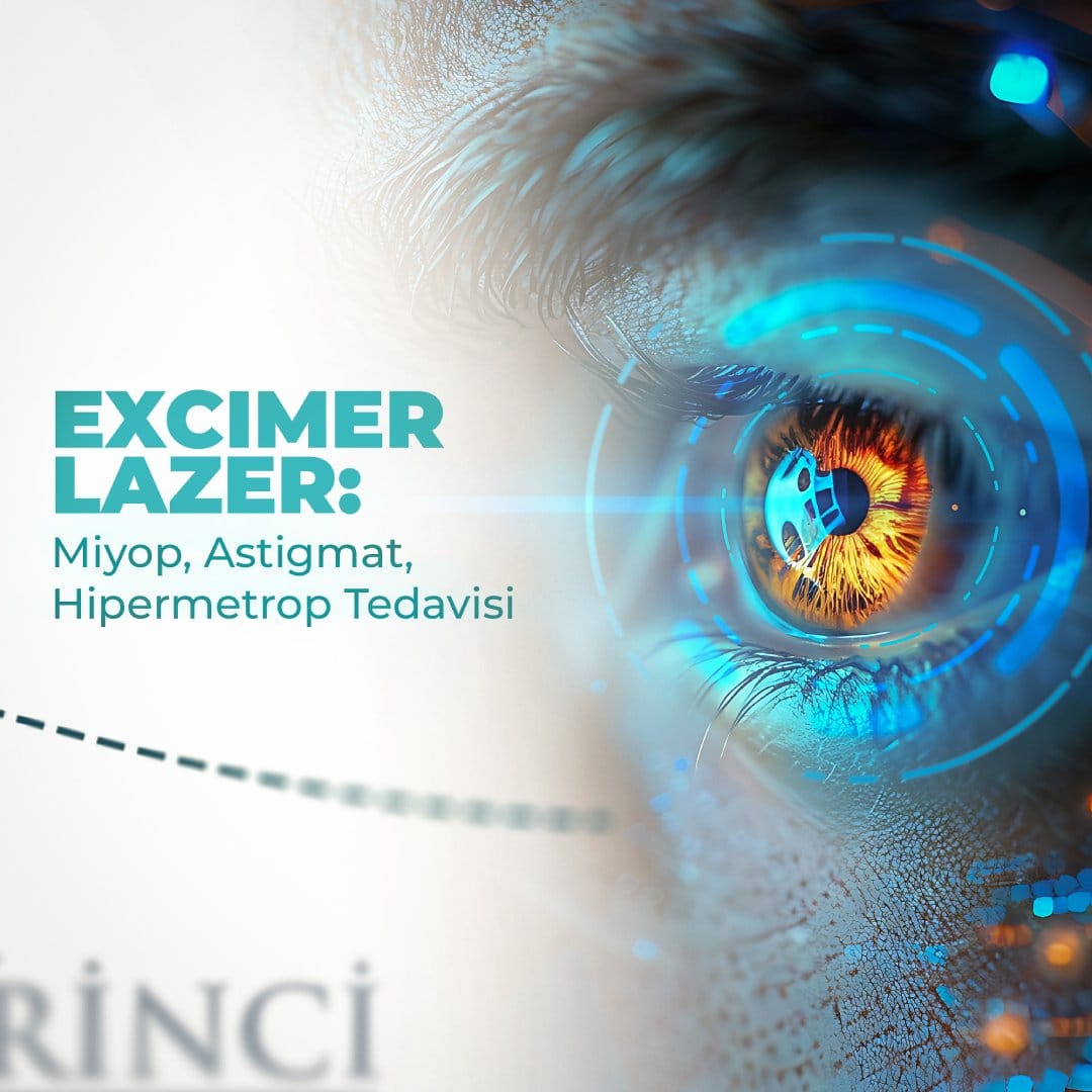 Excimer Lazer ile Kırma Kusurlarına Son Excimer lazer ile miyop ve astigmat tedavisi