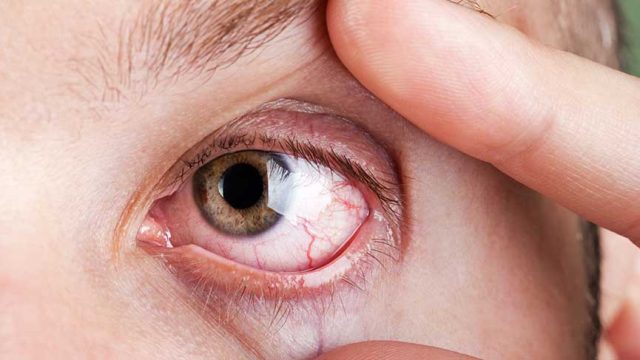 retina hastalıkları tedavisi beyliküdüzü Birinci göz hastanesi