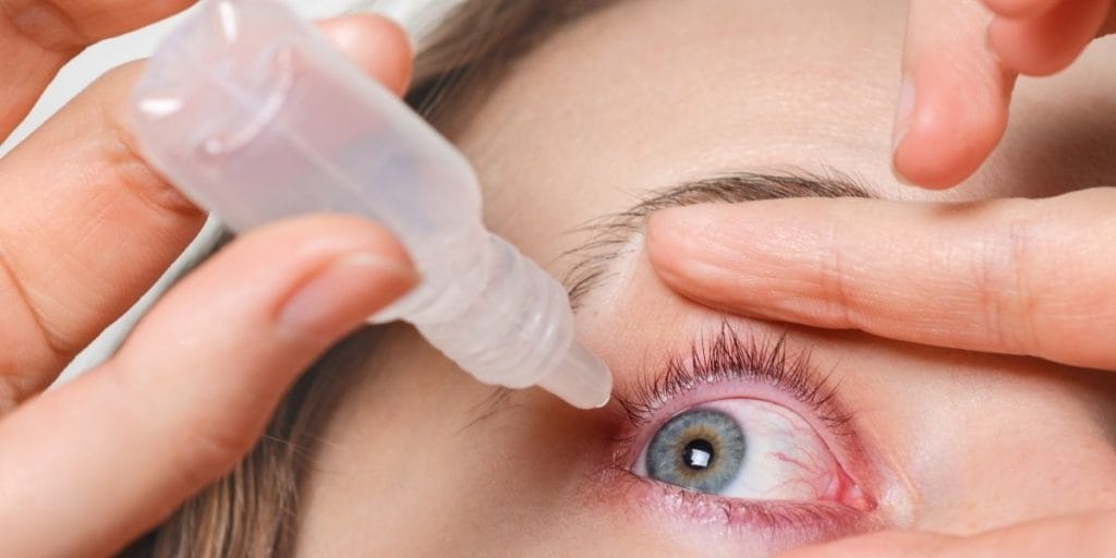 Göz kanlanması nasıl geçer?