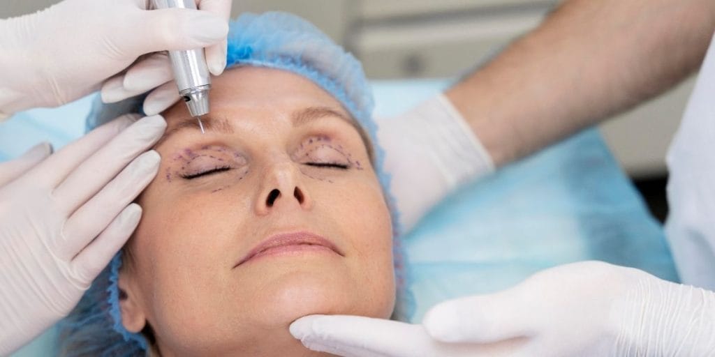 Göz kapağı estetiği nasıl yapılır?