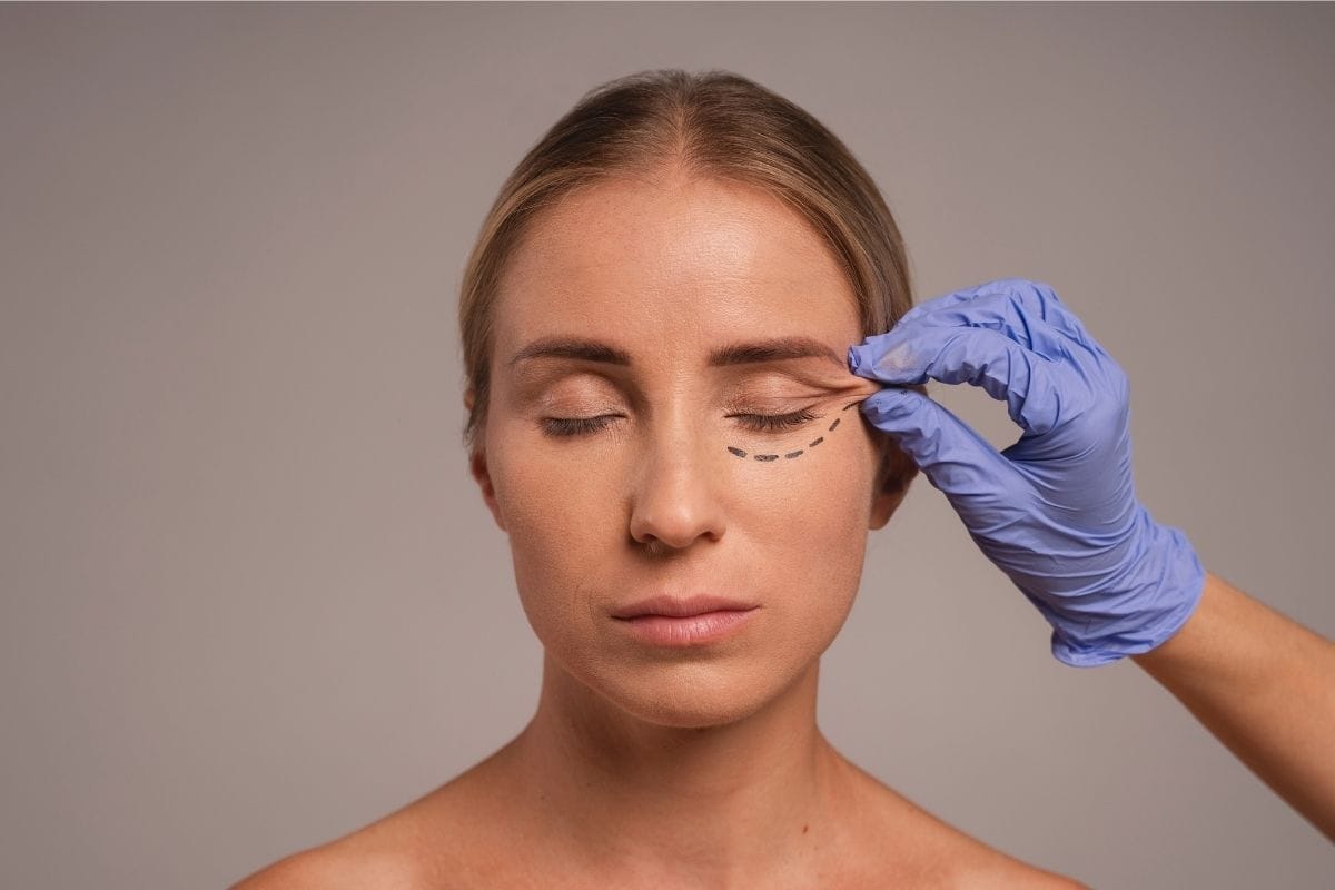 Göz kapağı estetiği nedir, nasıl yapılır ?