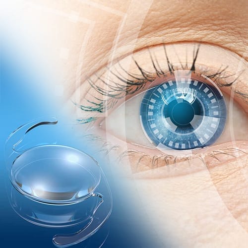 Akilli-Lens.jpg