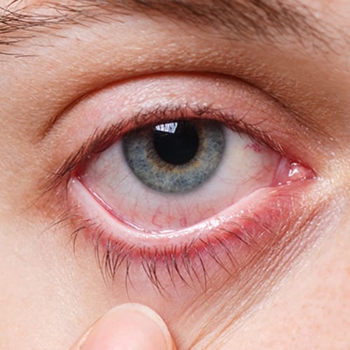 Retina-Hastaliklari.jpg