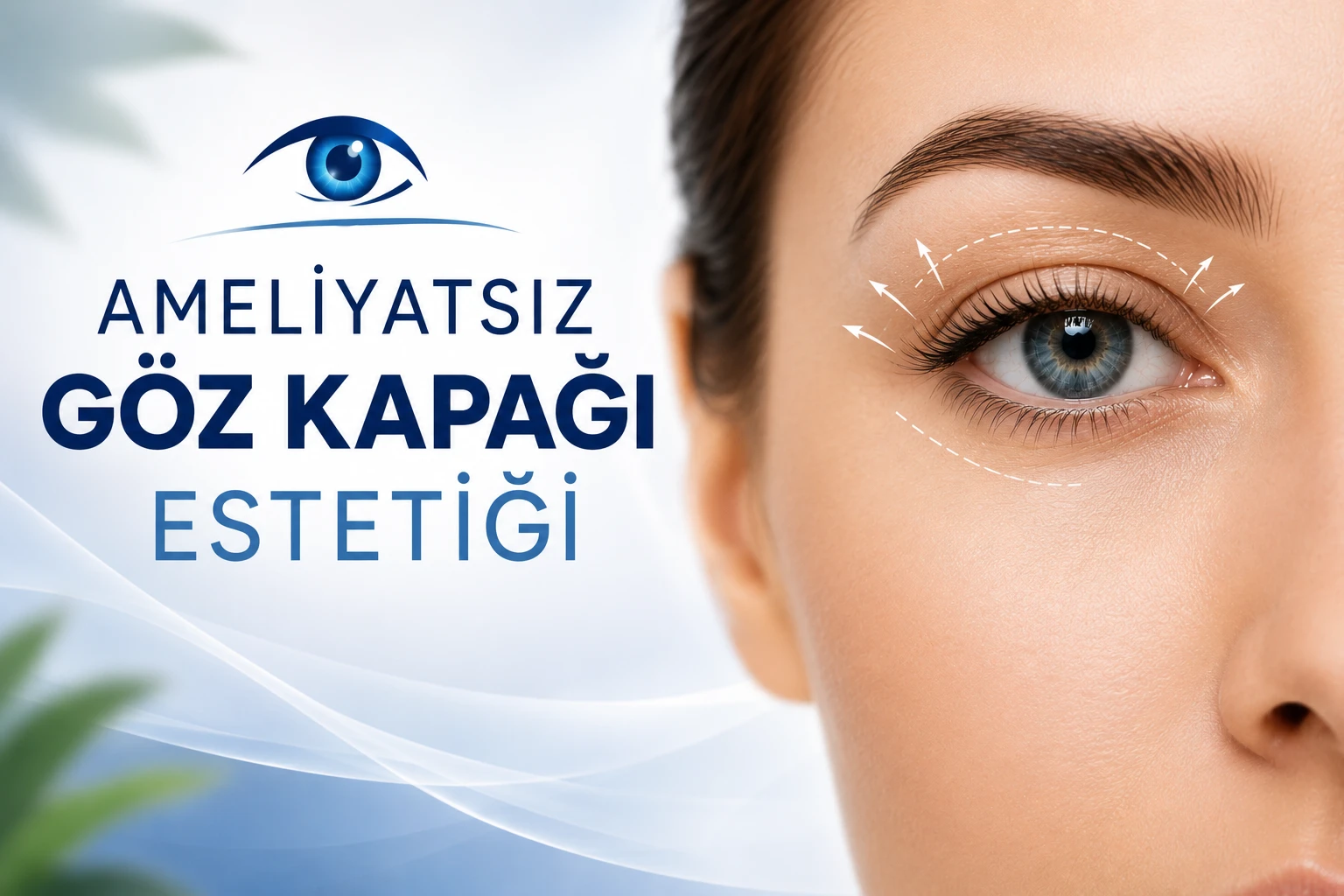 Ameliyatsız Göz Kapağı Estetiği Fiyatları